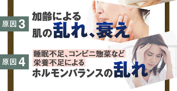 原因3：加齢による肌の乱れ、衰え　原因4：睡眠不足、コンビニ惣菜など栄養不足によるホルモンバランスの乱れ